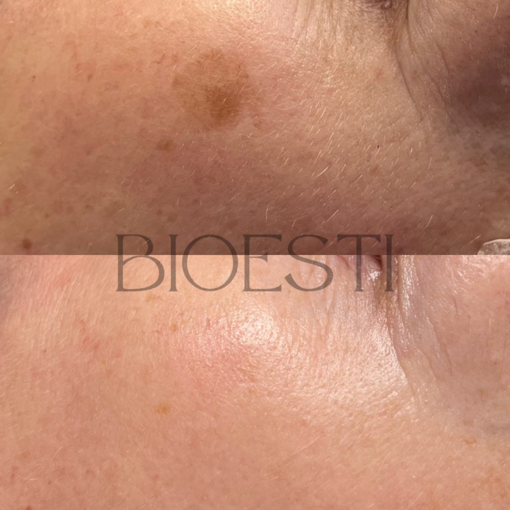 23CEC58D-3031-48B7-ABB6-412E111D083A