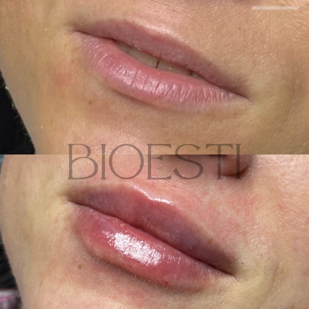 67FBB67D-15D1-4B98-8CFA-34455B0F25B2